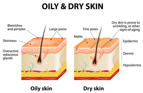 Oily skin vs dry skin