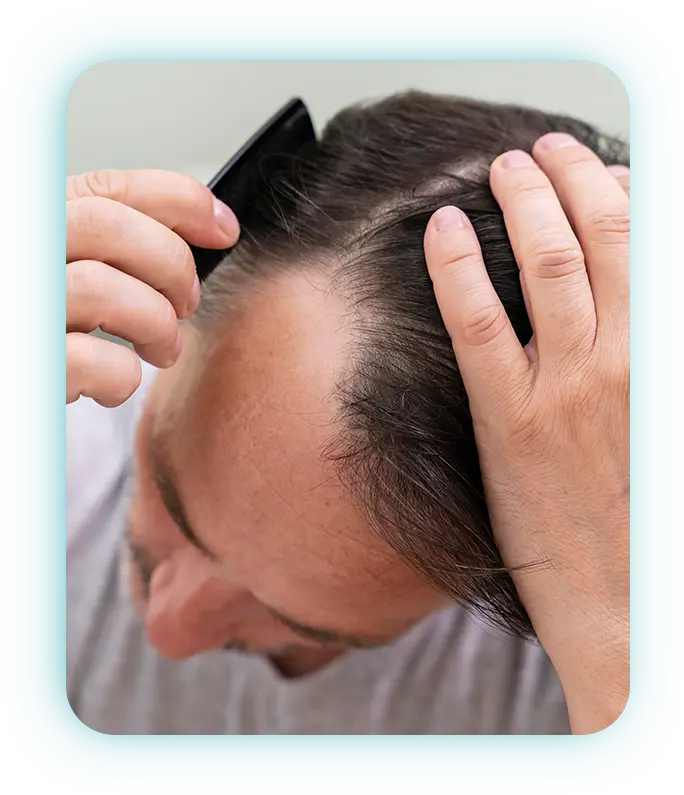 Individuals experiencing thinning hair or early signs of hair loss